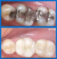Jessamine Family Dentistry image 3
